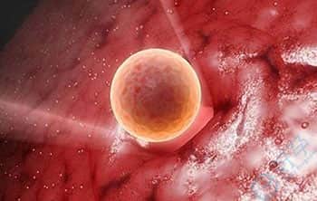 慢性宫颈炎是否会影响胚胎着床？赴美试管如何提高好孕率？