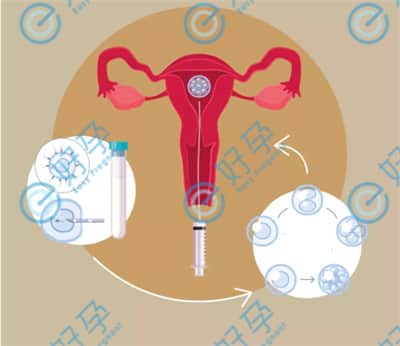 月经量少是卵巢功能在衰退吗？还能做试管婴儿吗？
