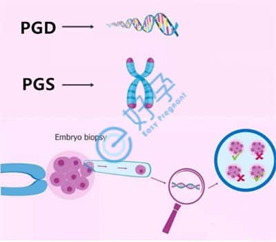 导致囊胚基因异常的原因分析-试管婴儿如何检测？