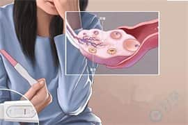 卵巢基础卵泡数量少，可以去泰国做试管完成促排吗？