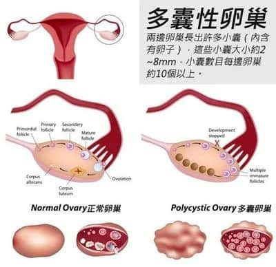 有过多次流产史做试管婴儿前需要注意哪些事项？