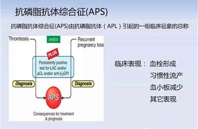 有过多次流产史做试管婴儿前需要注意哪些事项？