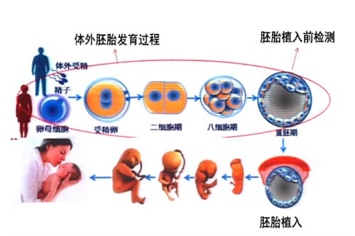 试管婴儿养囊的意义与规避胎儿染色体异常的方法