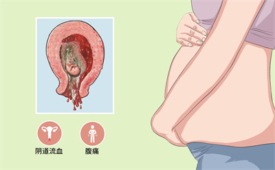 宫颈糜烂会给生育能力带来哪些危害?宫颈糜烂做试管婴儿如何提高成功率？