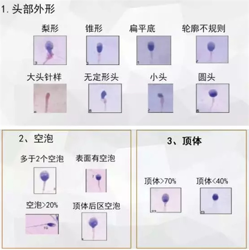 反复移植失败后，实验室调整这5点祝你好孕