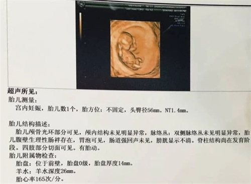 高龄怀孕不易，做好这3点提高成功率！