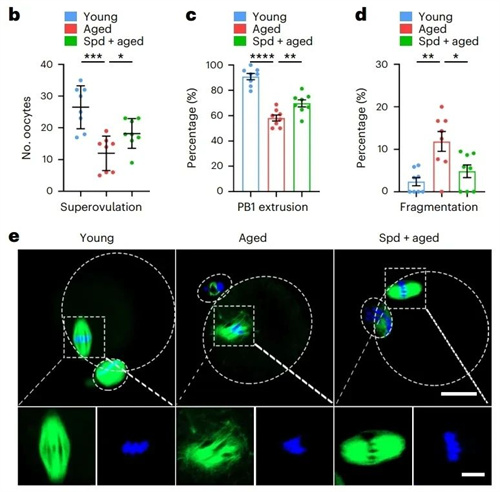 没想到这3种方式，能让老化卵母细胞重获新生！