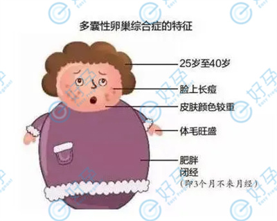 多囊卵巢怀孕的秘诀——做试管婴儿：开启生育新希望