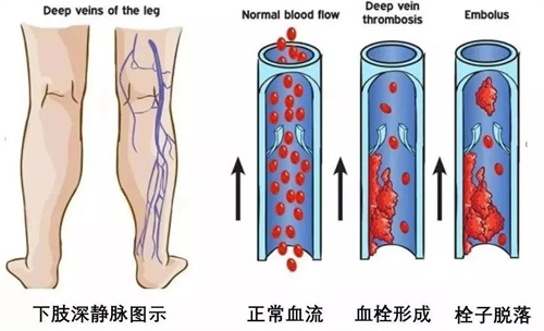 试管婴儿科普：胚胎移植后的那些小心翼翼，你做到了吗？