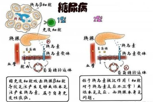 肥胖对女性生育的影响，如何进行科学的孕前体重管理？