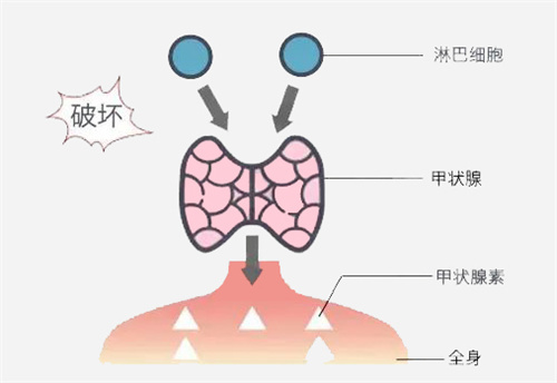 AMH低、卵子差就打生长激素？很多人第一步就错了！6个隐形卡点别忽视